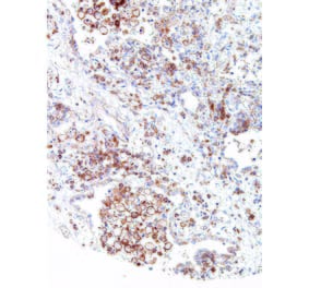 Immunohistochemistry - Anti-CMTM6 Antibody [IHC700] (A324450) - Antibodies.com