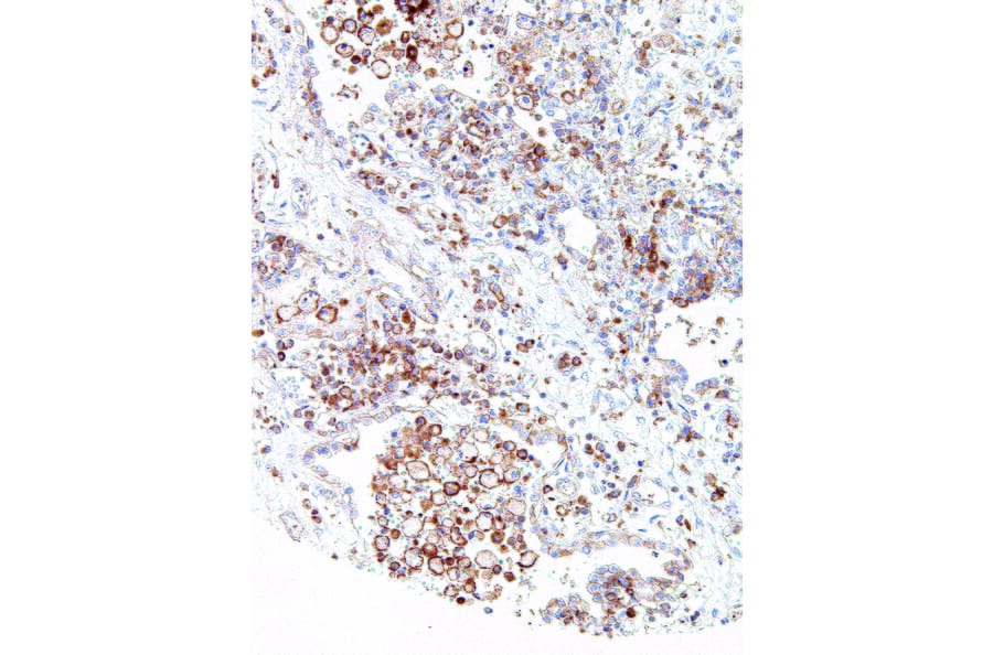 Immunohistochemistry - Anti-CMTM6 Antibody [IHC700] (A324450) - Antibodies.com