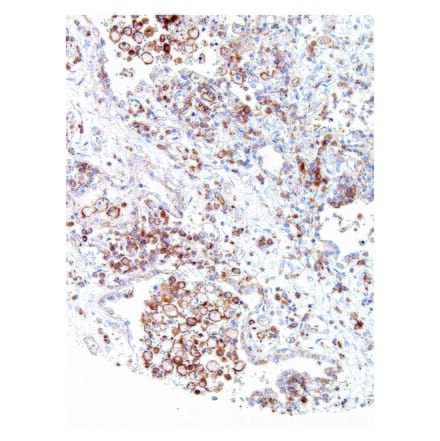 Immunohistochemistry - Anti-CMTM6 Antibody [IHC700] (A324450) - Antibodies.com