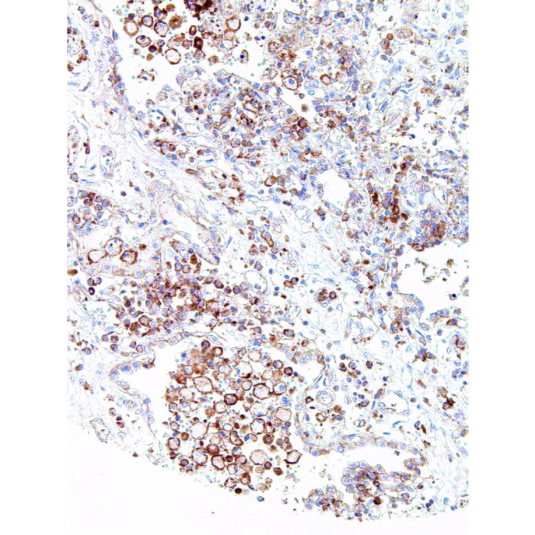 Immunohistochemistry - Anti-CMTM6 Antibody [IHC700] (A324450) - Antibodies.com