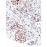 Immunohistochemistry - Anti-CMTM6 Antibody [IHC700] (A324450) - Antibodies.com