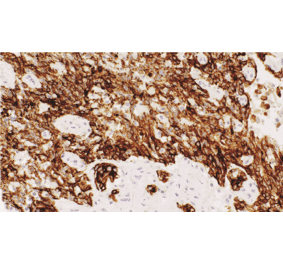 Immunohistochemistry - Anti-Acidic Cytokeratin Antibody [IHC201] (A324451) - Antibodies.com