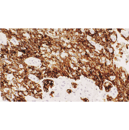 Immunohistochemistry - Anti-Acidic Cytokeratin Antibody [IHC201] (A324451) - Antibodies.com