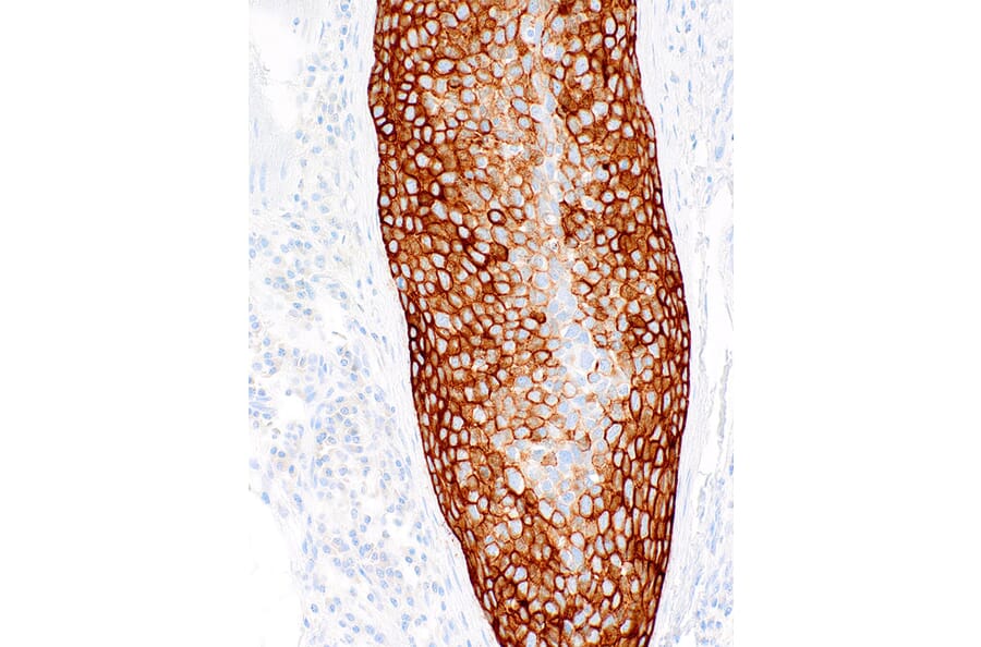 Immunohistochemistry - Anti-Cytokeratin 5 + 6 Antibody [IHC556] (A324454) - Antibodies.com