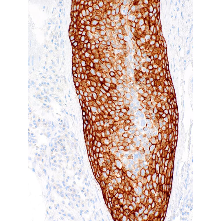 Immunohistochemistry - Anti-Cytokeratin 5 + 6 Antibody [IHC556] (A324454) - Antibodies.com