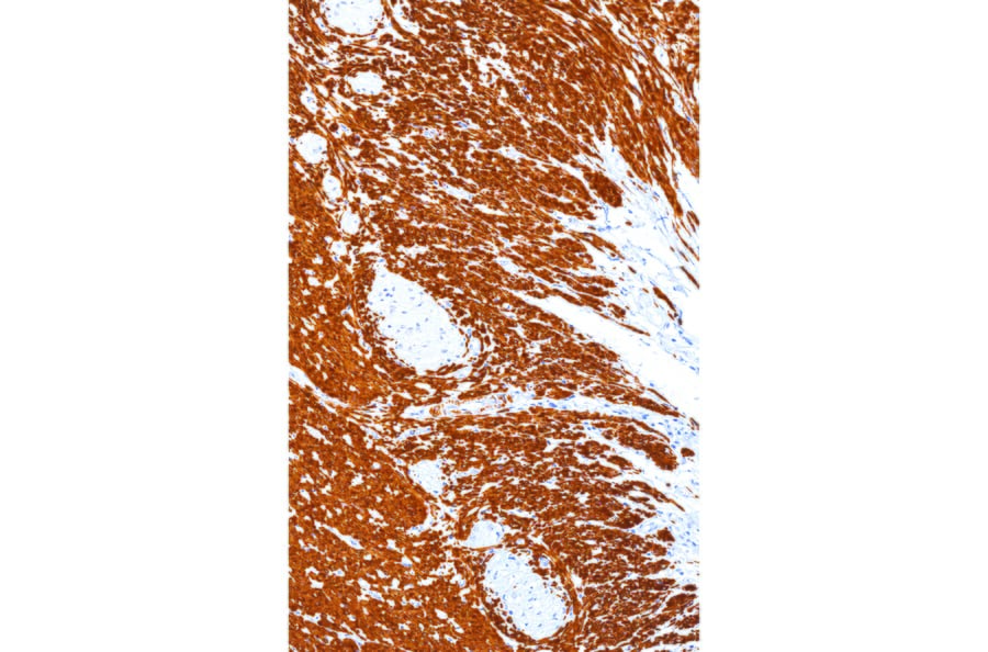 Immunohistochemistry - Anti-Desmin Antibody [IHC561] (A324455) - Antibodies.com