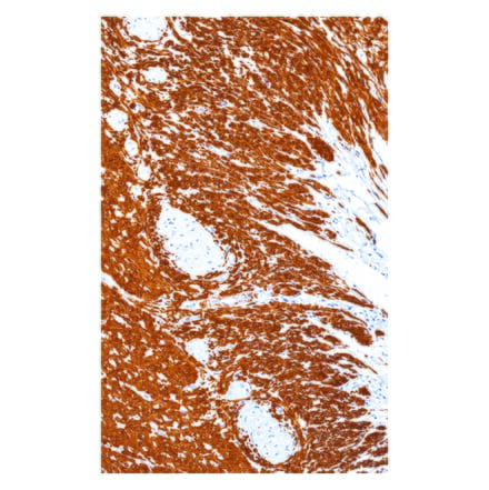 Immunohistochemistry - Anti-Desmin Antibody [IHC561] (A324455) - Antibodies.com