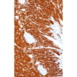 Immunohistochemistry - Anti-Desmin Antibody [IHC561] (A324455) - Antibodies.com