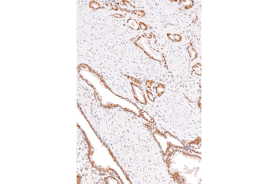 Immunohistochemistry - Anti-ERCC1 Antibody [IHC568] (A324458) - Antibodies.com