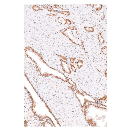 Immunohistochemistry - Anti-ERCC1 Antibody [IHC568] (A324458) - Antibodies.com