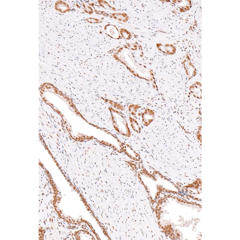 Immunohistochemistry - Anti-ERCC1 Antibody [IHC568] (A324458) - Antibodies.com