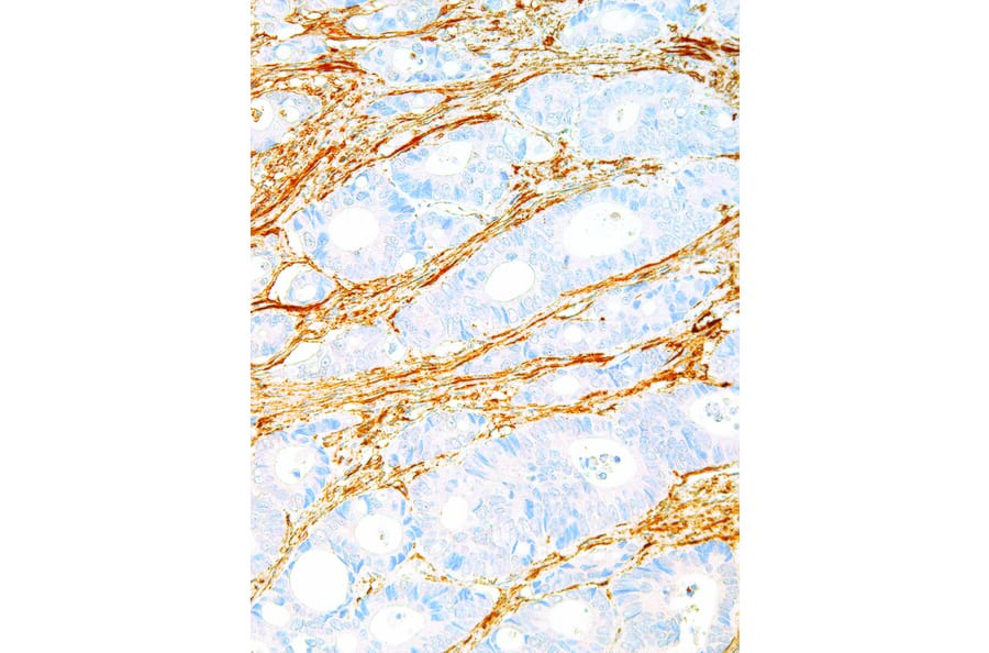 Immunohistochemistry - Anti-Fibronectin Antibody [IHC575] (A324460) - Antibodies.com