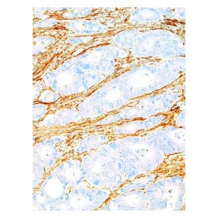 Immunohistochemistry - Anti-Fibronectin Antibody [IHC575] (A324460) - Antibodies.com