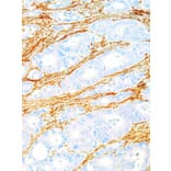 Immunohistochemistry - Anti-Fibronectin Antibody [IHC575] (A324460) - Antibodies.com