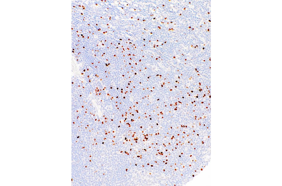 Immunohistochemistry - Anti-FOXP3 Antibody [IHC773] (A324462) - Antibodies.com