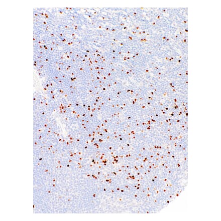 Immunohistochemistry - Anti-FOXP3 Antibody [IHC773] (A324462) - Antibodies.com