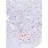 Immunohistochemistry - Anti-FOXP3 Antibody [IHC773] (A324462) - Antibodies.com