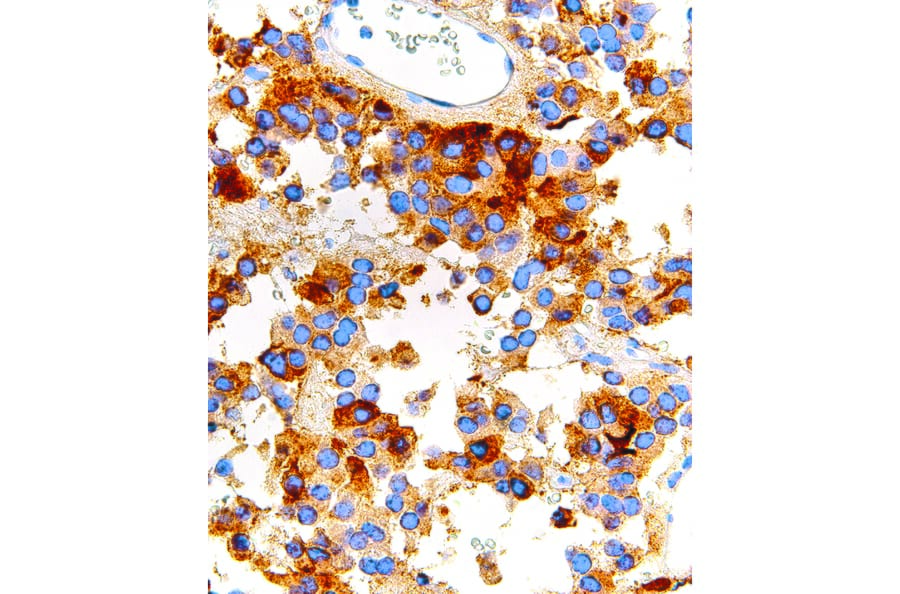 Immunohistochemistry - Anti-FSH Antibody [IHC580] (A324463) - Antibodies.com