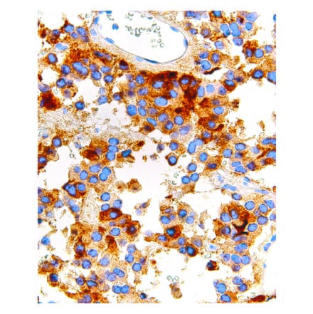 Immunohistochemistry - Anti-FSH Antibody [IHC580] (A324463) - Antibodies.com