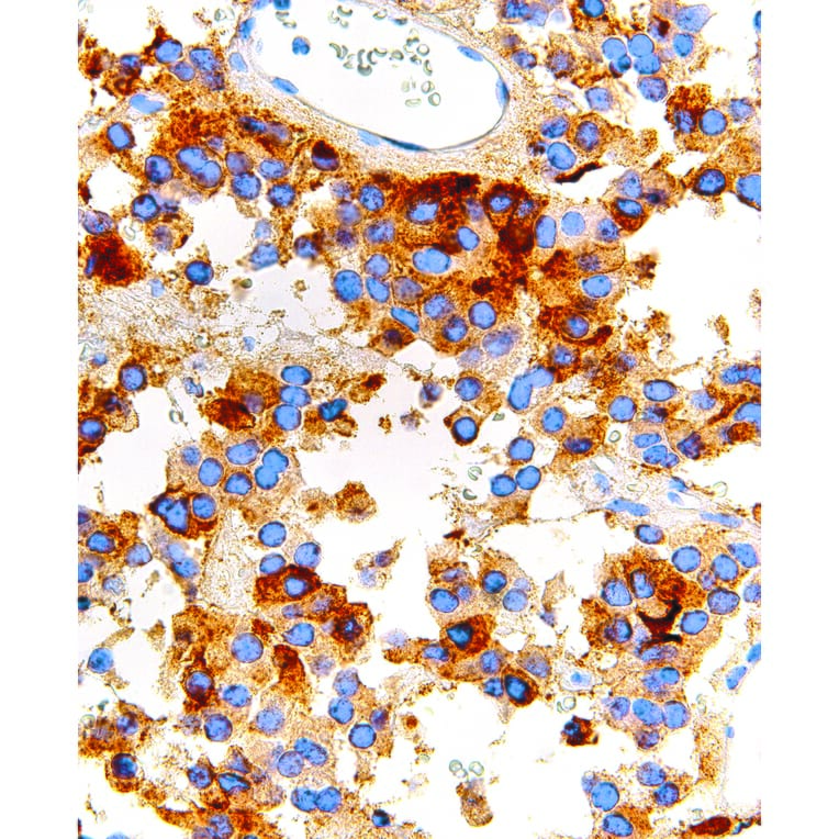 Immunohistochemistry - Anti-FSH Antibody [IHC580] (A324463) - Antibodies.com