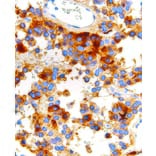 Immunohistochemistry - Anti-FSH Antibody [IHC580] (A324463) - Antibodies.com