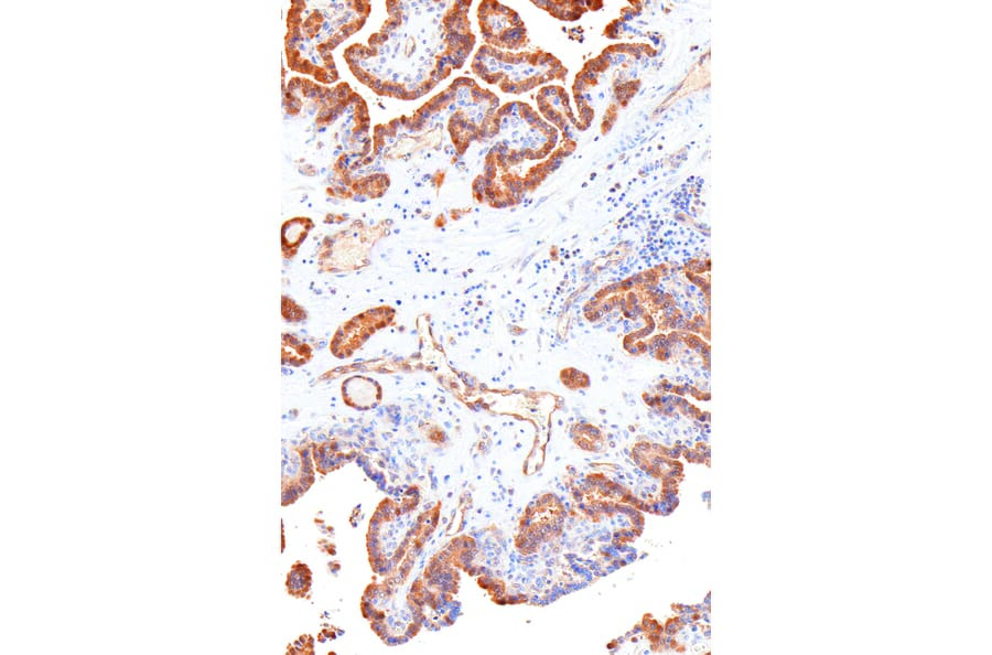 Immunohistochemistry - Anti-Galectin 3 Antibody [IHC581] (A324464) - Antibodies.com