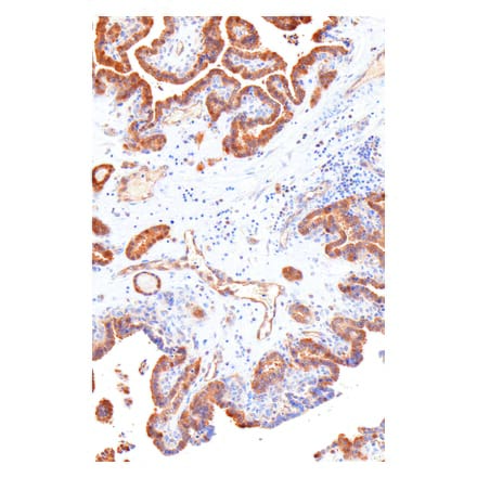 Immunohistochemistry - Anti-Galectin 3 Antibody [IHC581] (A324464) - Antibodies.com
