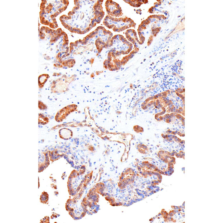 Immunohistochemistry - Anti-Galectin 3 Antibody [IHC581] (A324464) - Antibodies.com