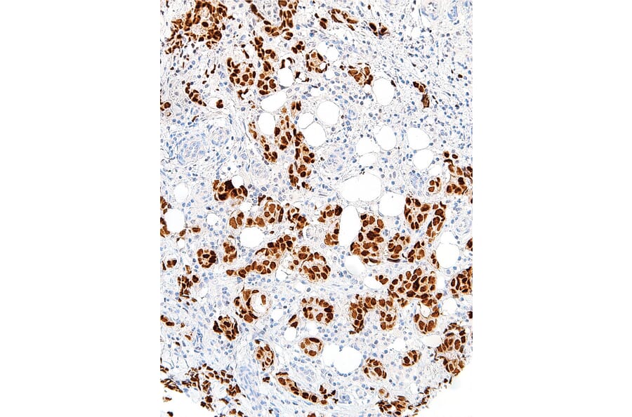 Immunohistochemistry - Anti-GATA3 Antibody [IHC583] (A324465) - Antibodies.com