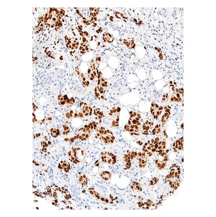 Immunohistochemistry - Anti-GATA3 Antibody [IHC583] (A324465) - Antibodies.com