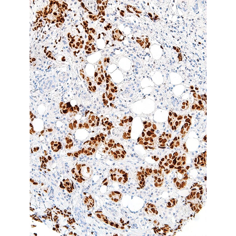 Immunohistochemistry - Anti-GATA3 Antibody [IHC583] (A324465) - Antibodies.com