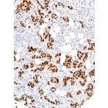 Immunohistochemistry - Anti-GATA3 Antibody [IHC583] (A324465) - Antibodies.com