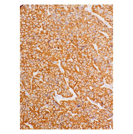 Immunohistochemistry - Anti-Growth Hormone Antibody [IHC589] (A324467) - Antibodies.com