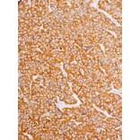 Immunohistochemistry - Anti-Growth Hormone Antibody [IHC589] (A324467) - Antibodies.com