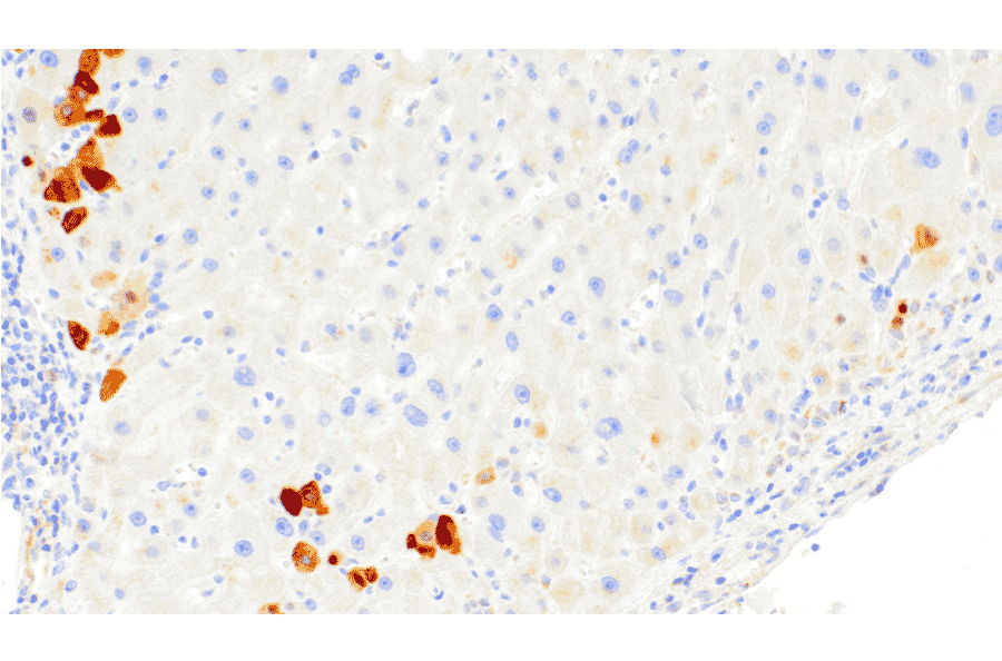 Immunohistochemistry - Anti-Hepatitis B Virus Core Antigen Antibody [IHC205] (A324468) - Antibodies.com