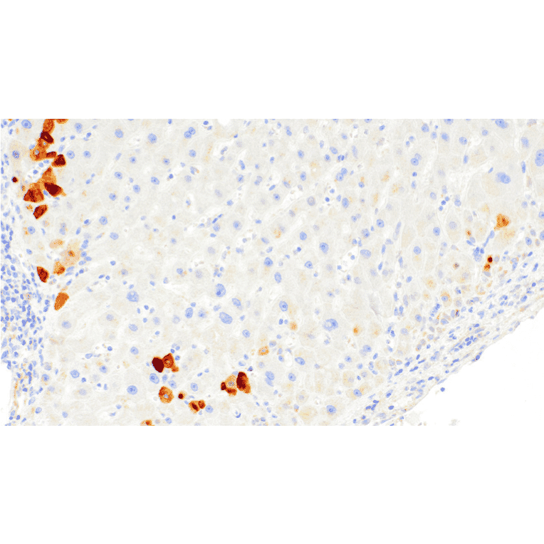 Immunohistochemistry - Anti-Hepatitis B Virus Core Antigen Antibody [IHC205] (A324468) - Antibodies.com