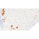 Immunohistochemistry - Anti-Hepatitis B Virus Core Antigen Antibody [IHC205] (A324468) - Antibodies.com