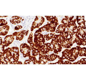 Immunohistochemistry - Anti-Hepatocyte Specific Antigen Antibody [IHC596] (A324469) - Antibodies.com