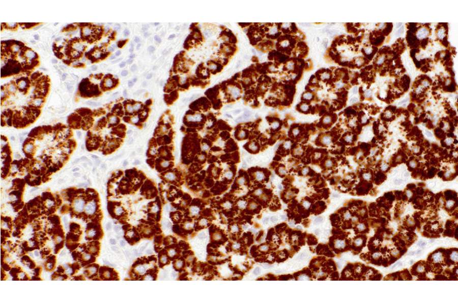 Immunohistochemistry - Anti-Hepatocyte Specific Antigen Antibody [IHC596] (A324469) - Antibodies.com