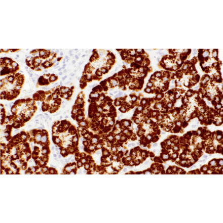 Immunohistochemistry - Anti-Hepatocyte Specific Antigen Antibody [IHC596] (A324469) - Antibodies.com
