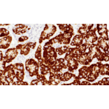 Immunohistochemistry - Anti-Hepatocyte Specific Antigen Antibody [IHC596] (A324469) - Antibodies.com