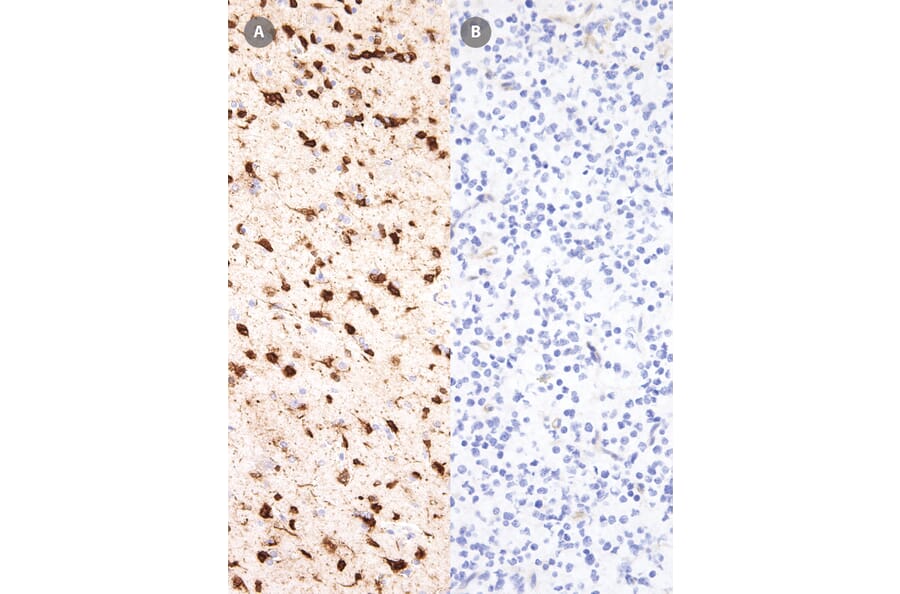 Immunohistochemistry - Anti-IDH1 (mutated R132H) Antibody [IHC132] (A324470) - Antibodies.com