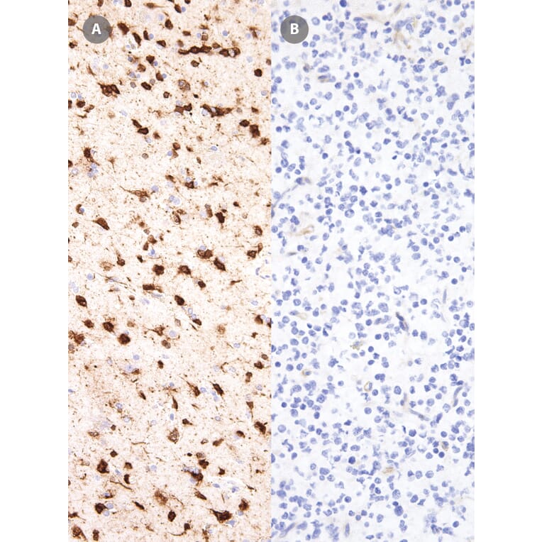 Immunohistochemistry - Anti-IDH1 (mutated R132H) Antibody [IHC132] (A324470) - Antibodies.com