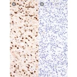 Immunohistochemistry - Anti-IDH1 (mutated R132H) Antibody [IHC132] (A324470) - Antibodies.com