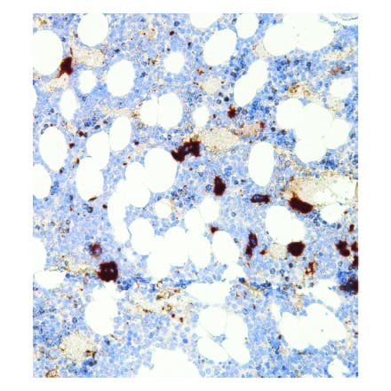 Immunohistochemistry - Anti-Integrin beta 3 Antibody [IHC061] (A324472) - Antibodies.com