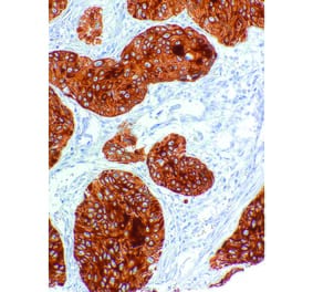 Immunohistochemistry - Anti-Cytokeratin 2 Antibody [IHC203] (A324473) - Antibodies.com