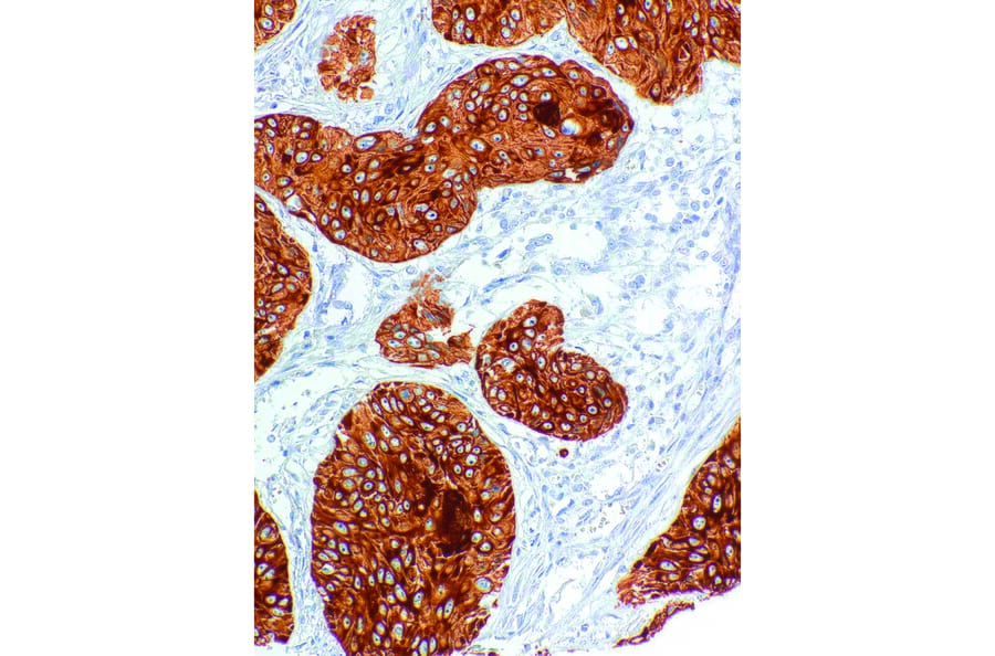 Immunohistochemistry - Anti-Cytokeratin 2 Antibody [IHC203] (A324473) - Antibodies.com