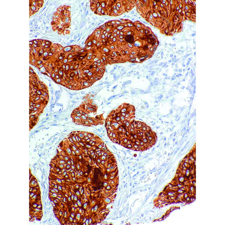 Immunohistochemistry - Anti-Cytokeratin 2 Antibody [IHC203] (A324473) - Antibodies.com