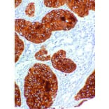Immunohistochemistry - Anti-Cytokeratin 2 Antibody [IHC203] (A324473) - Antibodies.com