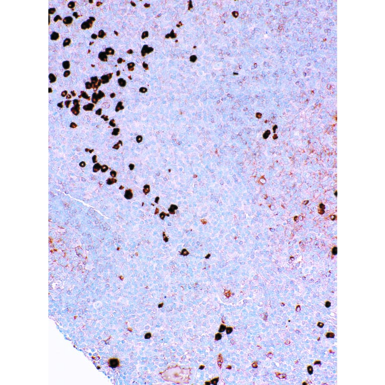 Immunohistochemistry - Anti-Lambda Light Chain Antibody [IHC709] (A324475) - Antibodies.com